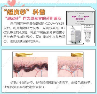 超皮秒祛斑原理介绍 超皮秒祛斑原理介绍