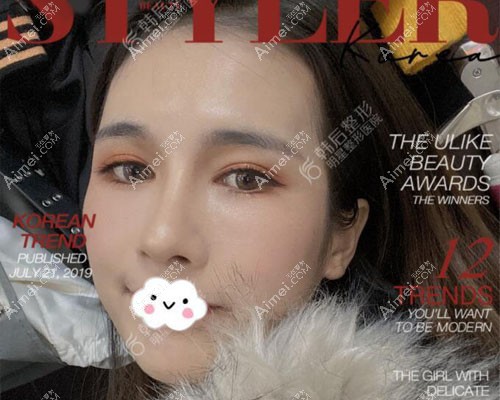 广州鼻修复哪家医院好?广州韩后鼻修复案例 广州鼻修复哪家医院好?广州韩后鼻修复案例