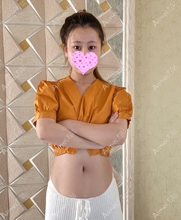 成都医大祛医院剖腹产疤痕增生去除效果图 成都医大祛医院剖腹产疤痕增生去除效果图