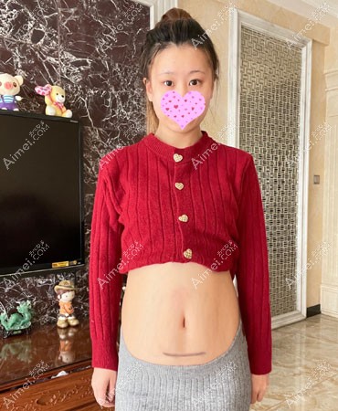 看我案例了解成都医大痕效果怎么样? 看我案例了解成都医大痕效果怎么样?