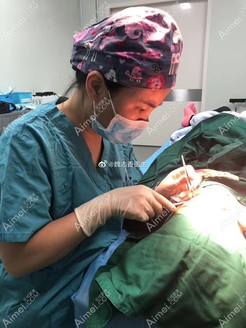 北京丽星翼美魏志香院长做膨体丰眉弓手术中状态.jpg 北京丽星翼美魏志香院长做膨体丰眉弓手术中状态.jpg