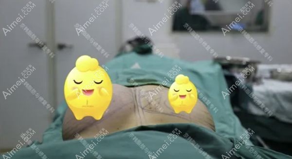 自体脂肪隆胸单侧即刻效果图.jpg 自体脂肪隆胸单侧即刻效果图.jpg