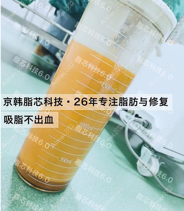 王沛森做自体脂肪隆胸前抽脂效果图.jpg 王沛森做自体脂肪隆胸前抽脂效果图.jpg