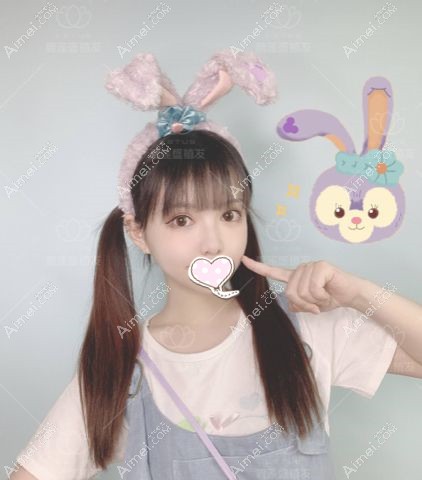 福州碧莲盛不剃发种植发际线1000单位术后5个月照片.jpg 福州碧莲盛不剃发种植发际线1000单位术后5个月照片.jpg