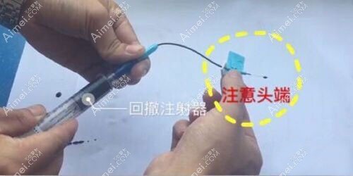 肋软骨隆鼻的手术台上扎滞留针太痛苦.jpg 肋软骨隆鼻的手术台上扎滞留针太痛苦.jpg