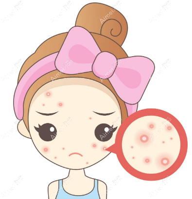 激光祛痘坑贴吧亲身经历分享 激光祛痘坑贴吧亲身经历分享