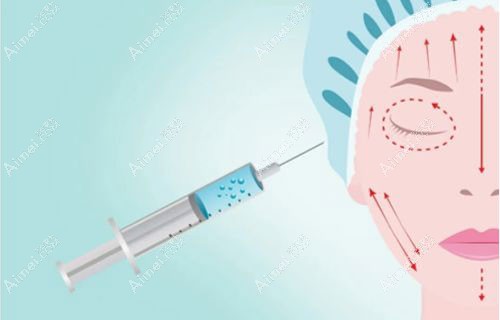 进口玻尿酸哪个牌子好?2022比较好的国外品牌看这份排名榜