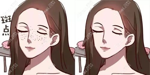 烟台知颜整形皮秒祛斑结果m.aimei.com.jpg 烟台知颜整形皮秒祛斑结果m.aimei.com.jpg