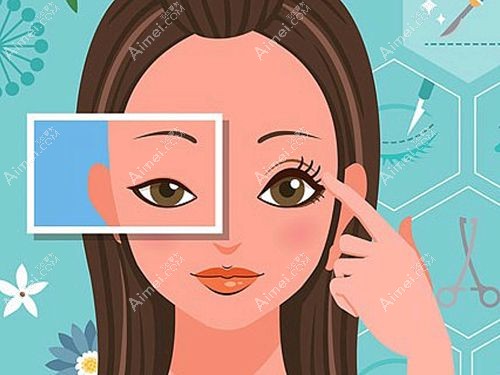 福州海峡李丽强割双眼皮手术实例分享m.aimei.com.jpg 福州海峡李丽强割双眼皮手术实例分享m.aimei.com.jpg