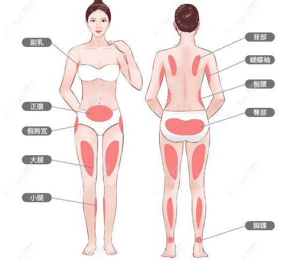 冯斌吸脂技术怎么样 冯斌吸脂技术怎么样