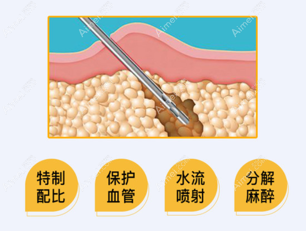 驻马店美兰德吸脂价格 驻马店美兰德吸脂价格