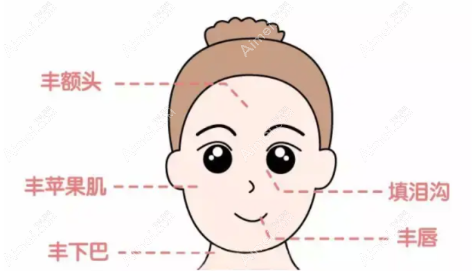 驻马店美兰德玻尿酸填充价格表 驻马店美兰德玻尿酸填充价格表