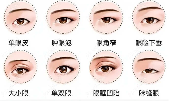 驻马店美兰德眼部整形价格 驻马店美兰德眼部整形价格