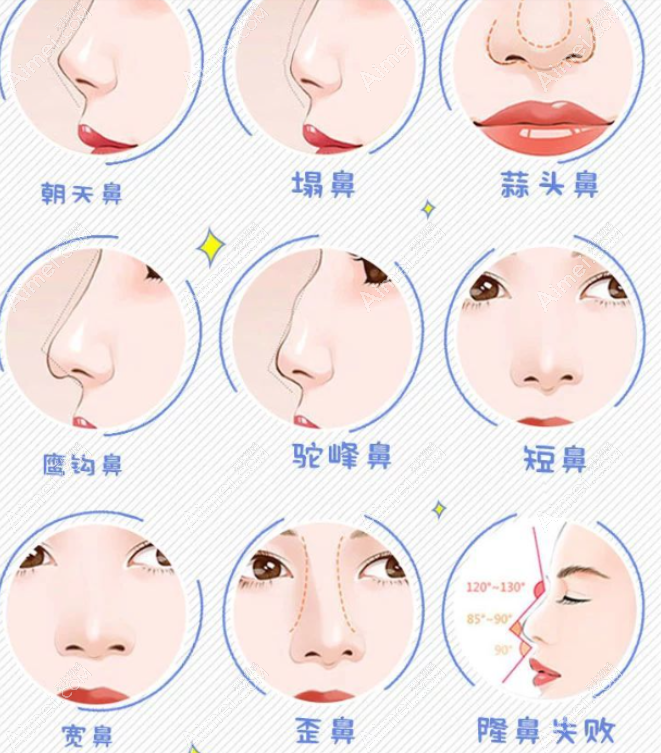 驻马店美兰德鼻部整形价格 驻马店美兰德鼻部整形价格