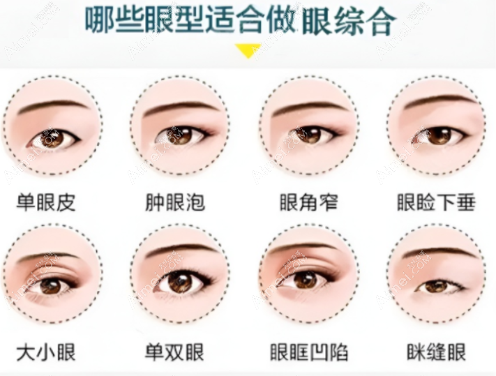 宜春名星初眼/眼综合整形价格 宜春名星初眼/眼综合整形价格