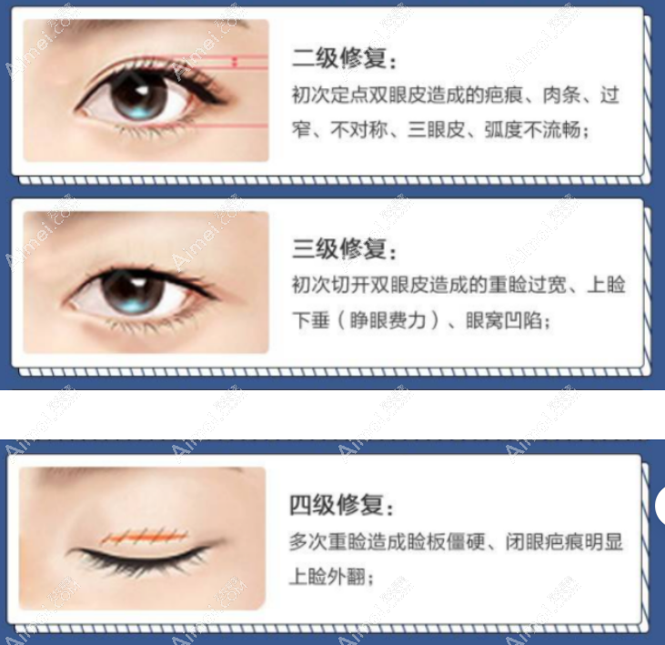 宜春名星眼修复价格是多少 宜春名星眼修复价格是多少