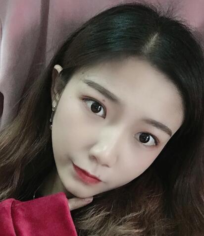 合肥华美整形美容医院隆鼻果记录分享,介绍实图查看