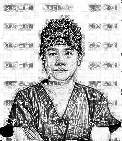 北京八大处隆鼻哪个医生好?术后介绍果在线分享!