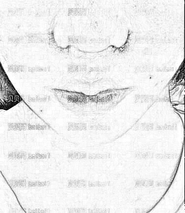 亲身经历!鼻翼缩小术后10天的终于来了