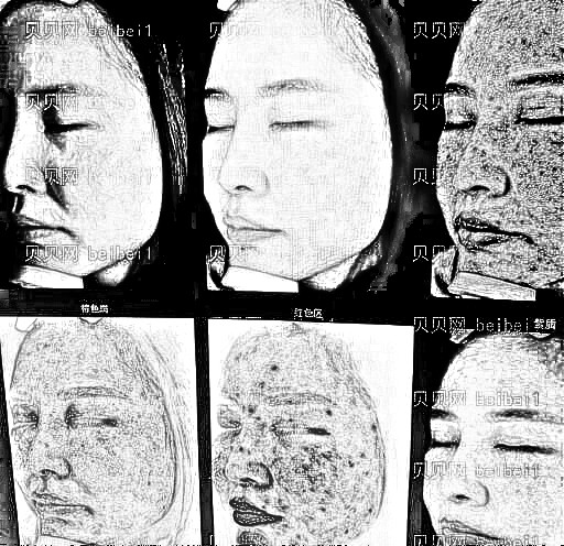 广州武警整形医院光子嫩肤体验:锁龄果太赞!