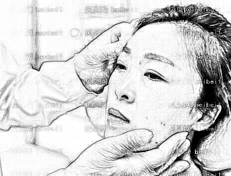 广州武警整形医院光子嫩肤体验:锁龄果太赞!