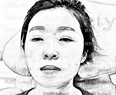 广州武警整形医院光子嫩肤体验:锁龄果太赞!