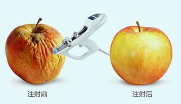 丽珠兰面部提升:测评果如何?是否如传闻一般?