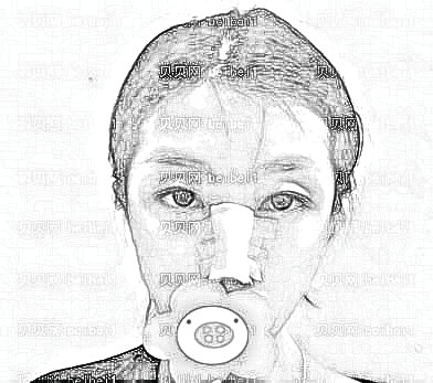 西安雁塔华旗唯美门诊部张沙沙隆鼻介绍片较新分享_才30多天感觉鼻子变得漂亮多了!