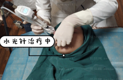 西京医院整形科樊星水光美肤介绍片较新分享_经过这次皮肤治疗,我也有了更大的信心了哦。