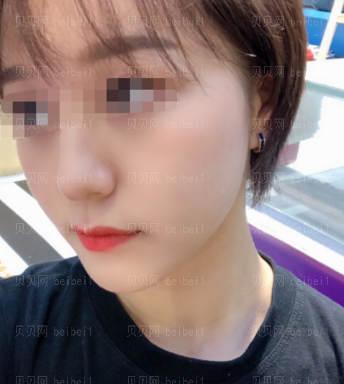 西京医院整形科樊星水光美肤介绍片较新分享_经过这次皮肤治疗,我也有了更大的信心了哦。