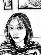 深圳富华医疗美容医院唐新辉埋线提升40-125天术后恢复过程分享~