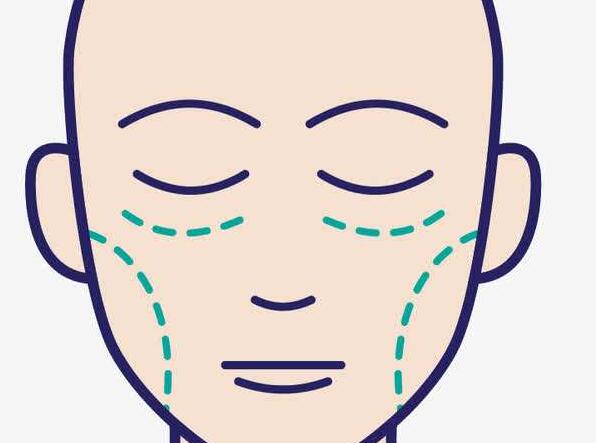 面部整形动漫03.jpg 面部整形动漫03.jpg