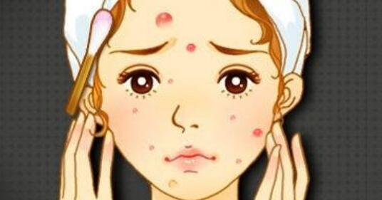 l祛痘q.jpg l祛痘q.jpg