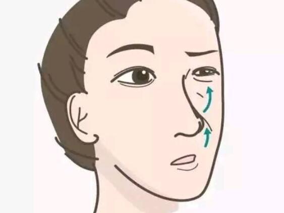 去法令纹动漫04.jpg 去法令纹动漫04.jpg