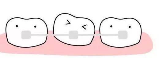 牙齿矫正动漫23.jpg 牙齿矫正动漫23.jpg