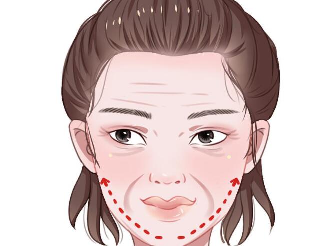 去法令纹动漫01.jpg 去法令纹动漫01.jpg