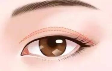 双眼皮动漫16.jpg 双眼皮动漫16.jpg