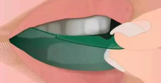 l瓷贴面q.jpg l瓷贴面q.jpg