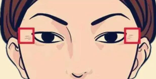 鱼尾纹动漫21.jpg 鱼尾纹动漫21.jpg