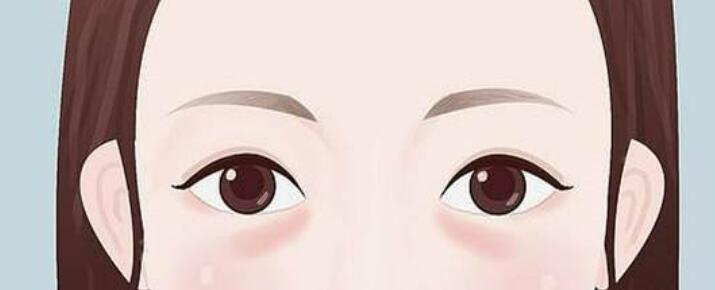 l去眼袋q01.jpg l去眼袋q01.jpg