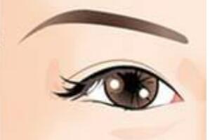 l双眼皮i1.jpg l双眼皮i1.jpg