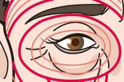 鱼尾纹动漫18.jpg 鱼尾纹动漫18.jpg