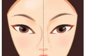 隆鼻动漫39.jpg 隆鼻动漫39.jpg