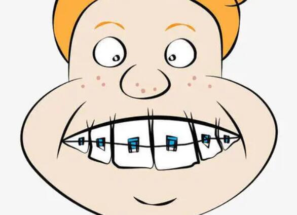 牙齿矫正动漫12.jpg 牙齿矫正动漫12.jpg