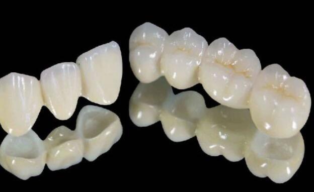 烤瓷牙动漫.jpg 烤瓷牙动漫.jpg