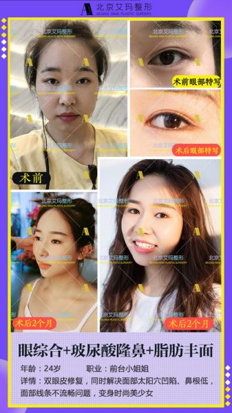 北京艾玛李方奇双眼皮修复技术怎么样?有双眼皮修复案例吗?