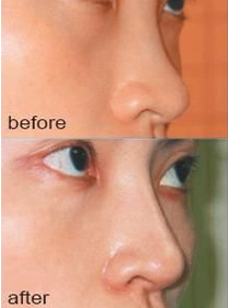 |ǲ|¡|轺¡|¡|¡|ʽ¡|¡|ǰ