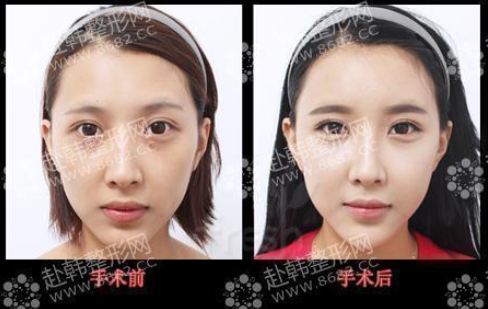 凯里雅典娜整形医院怎么样?口碑好不好? 凯里雅典娜整形医院怎么样?口碑好不好?