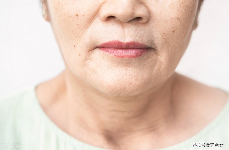 皱纹、松垂、凹陷,三大衰老症状,怎么解决?
