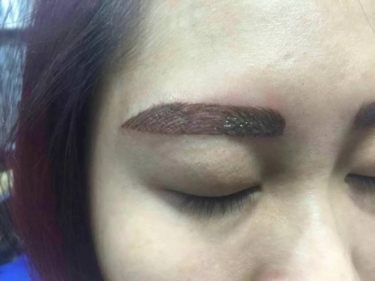 北京整形医院的医师告诉你洗眉要多少钱?